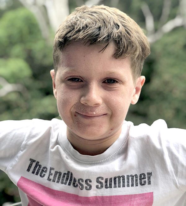 Ryder today, with his eczema mostly under control.