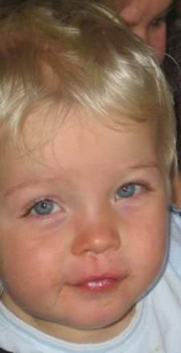 Sophie's son - FASD